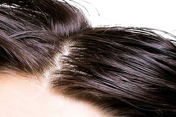 Cute Grassa - Capelli facilmente sporchi